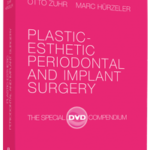 Plastic Esthetic Periodontal And Implant Surgery Otto Zuhr Marc Hurzeler Pdf